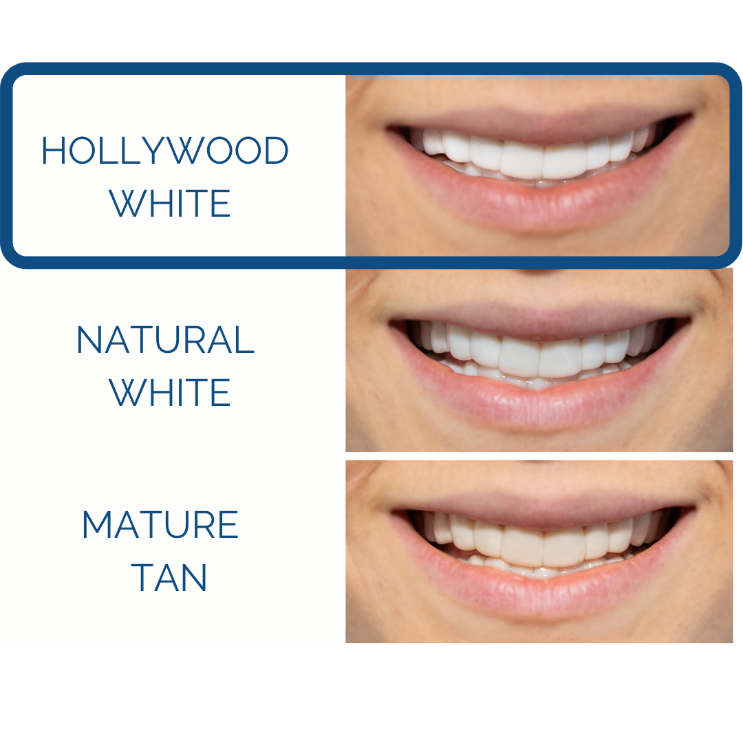 Instant Pop On Veneers (with Impression Kit)