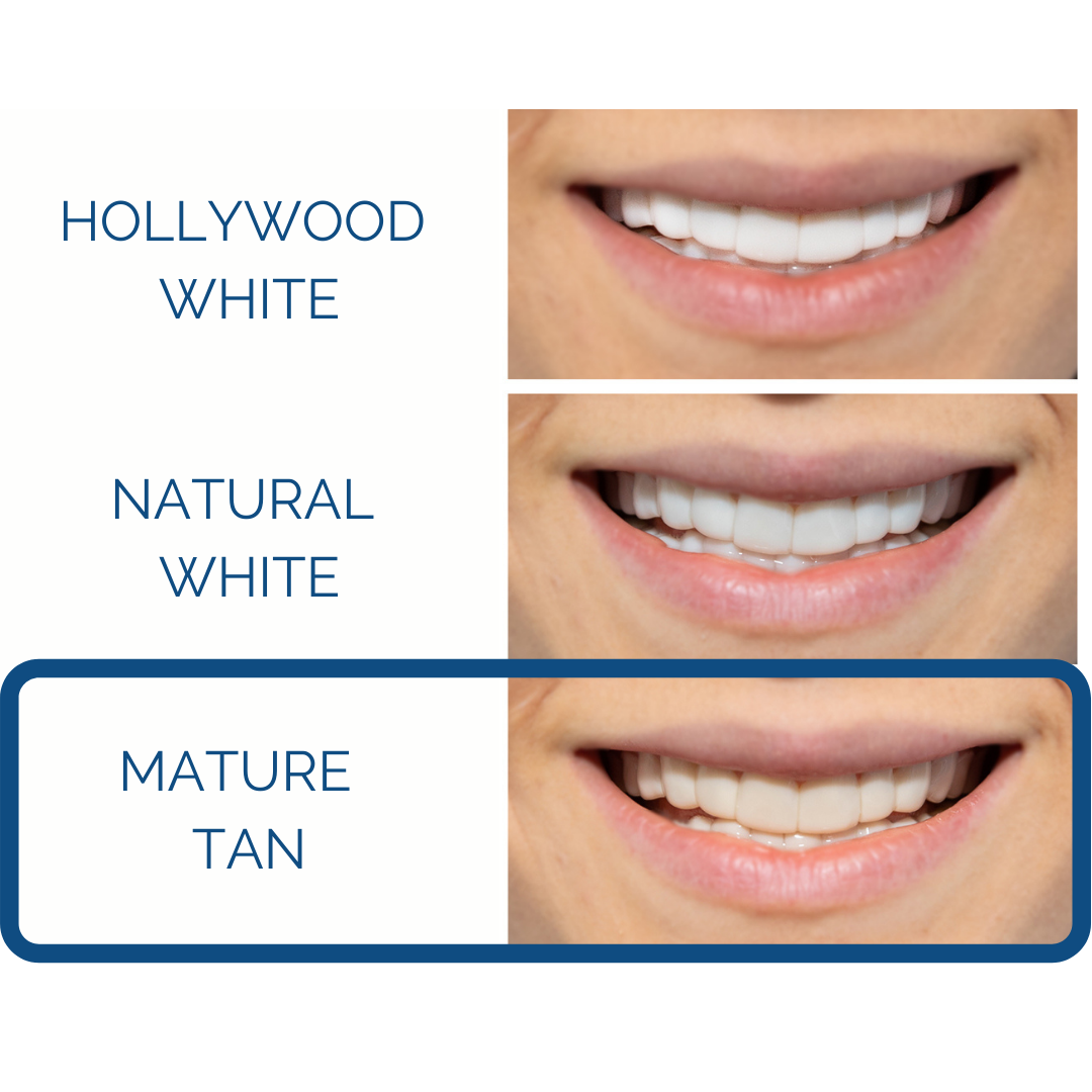 Instant Pop On Veneers (with Impression Kit)