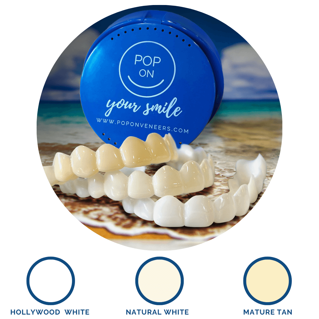 Instant Pop On Veneers (with Impression Kit)